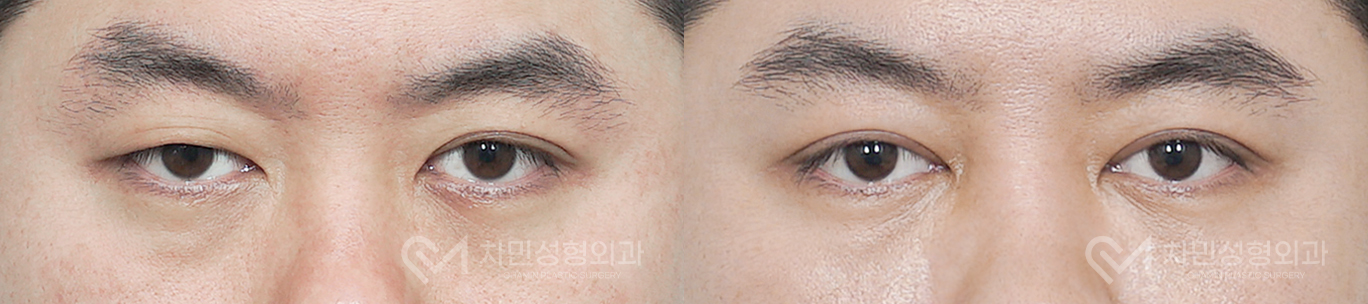 1번째 첨부파일