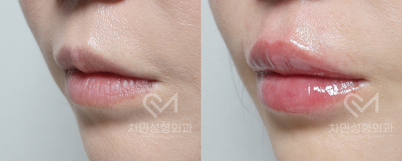2번째 첨부파일