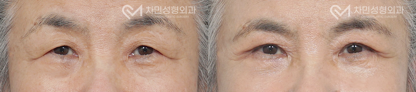 1번째 첨부파일
