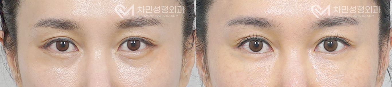 1번째 첨부파일