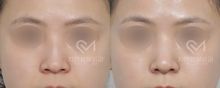 정면