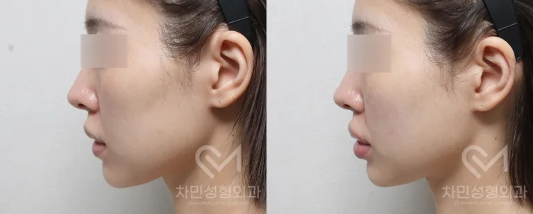 정면