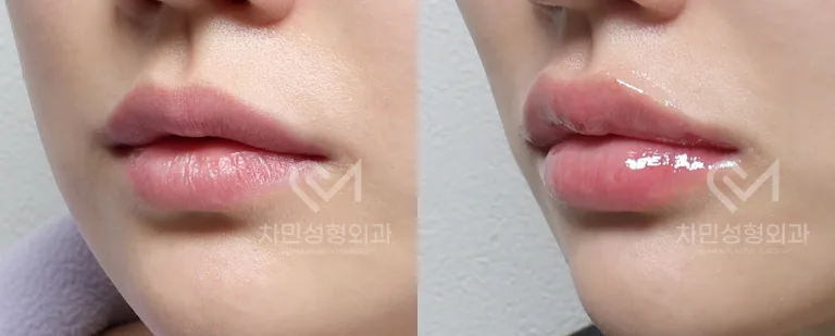 45도