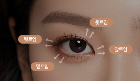트임성형 이미지