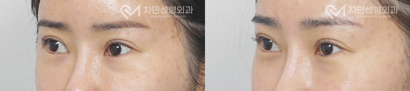 2번째 첨부파일