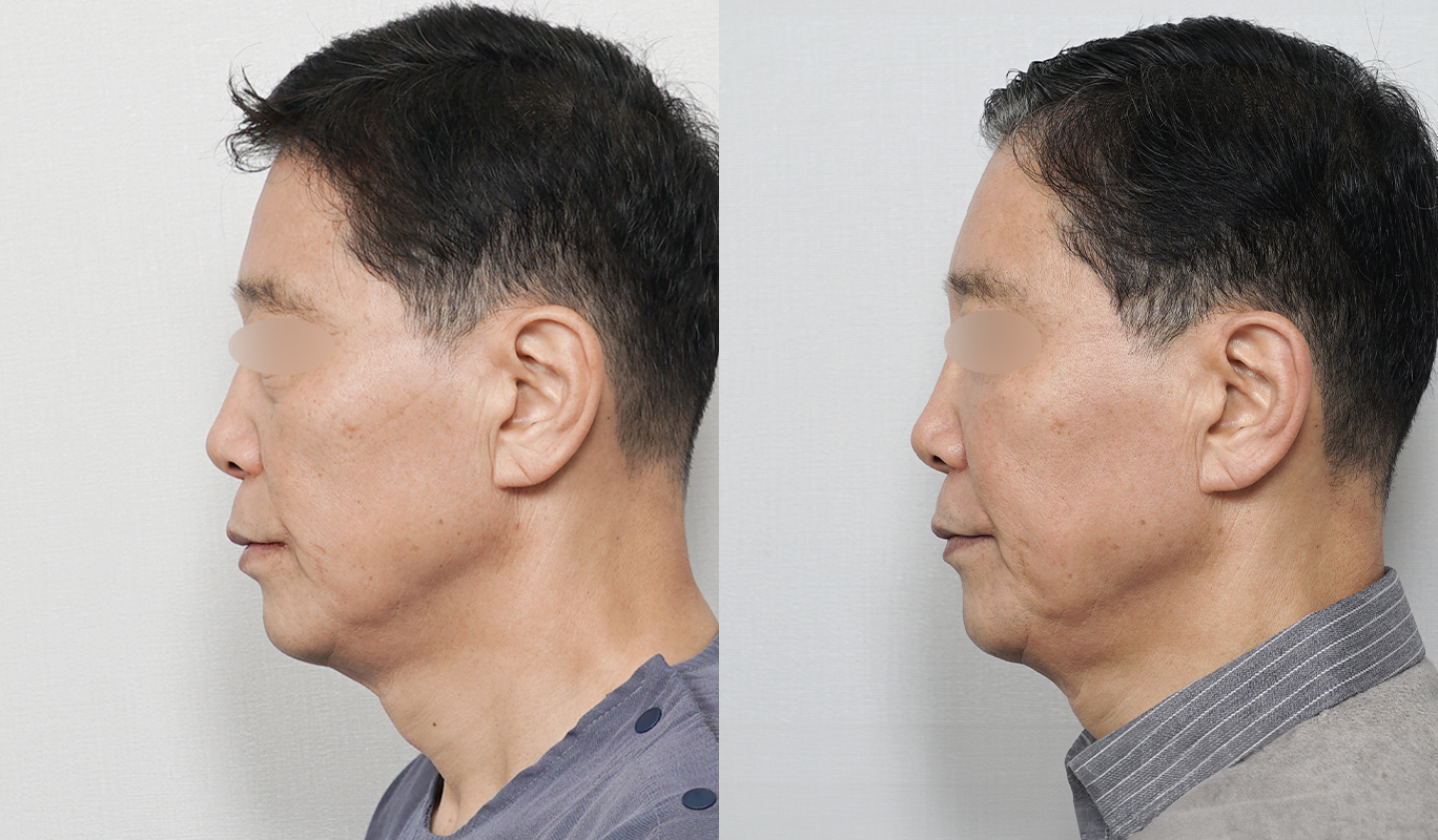 3번째 첨부파일