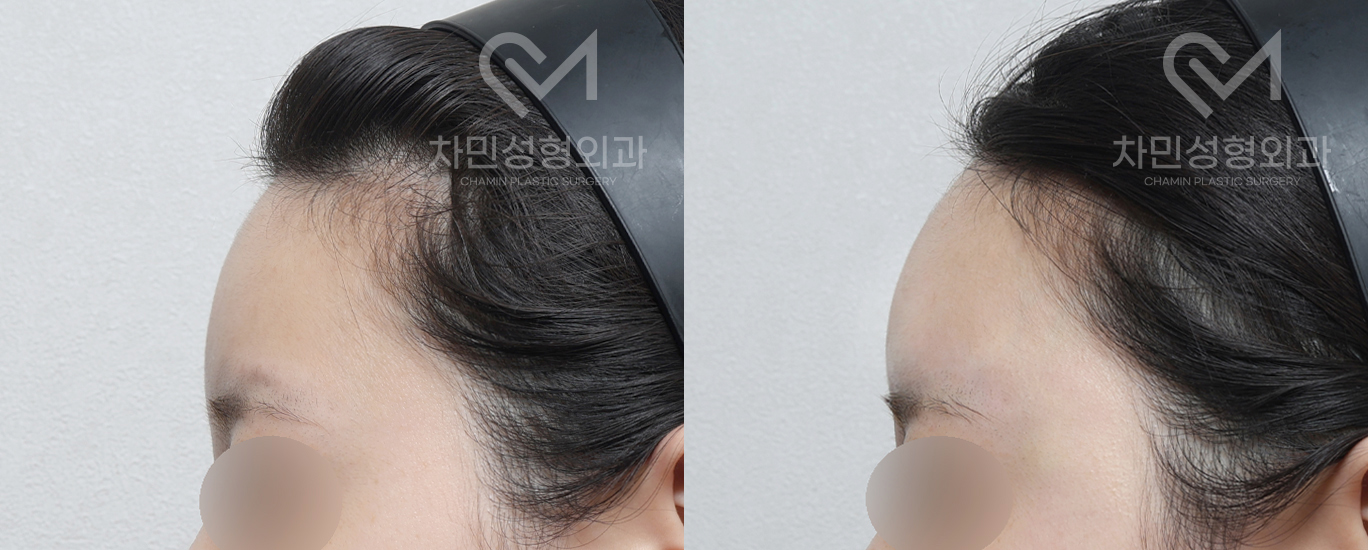 1번째 첨부파일