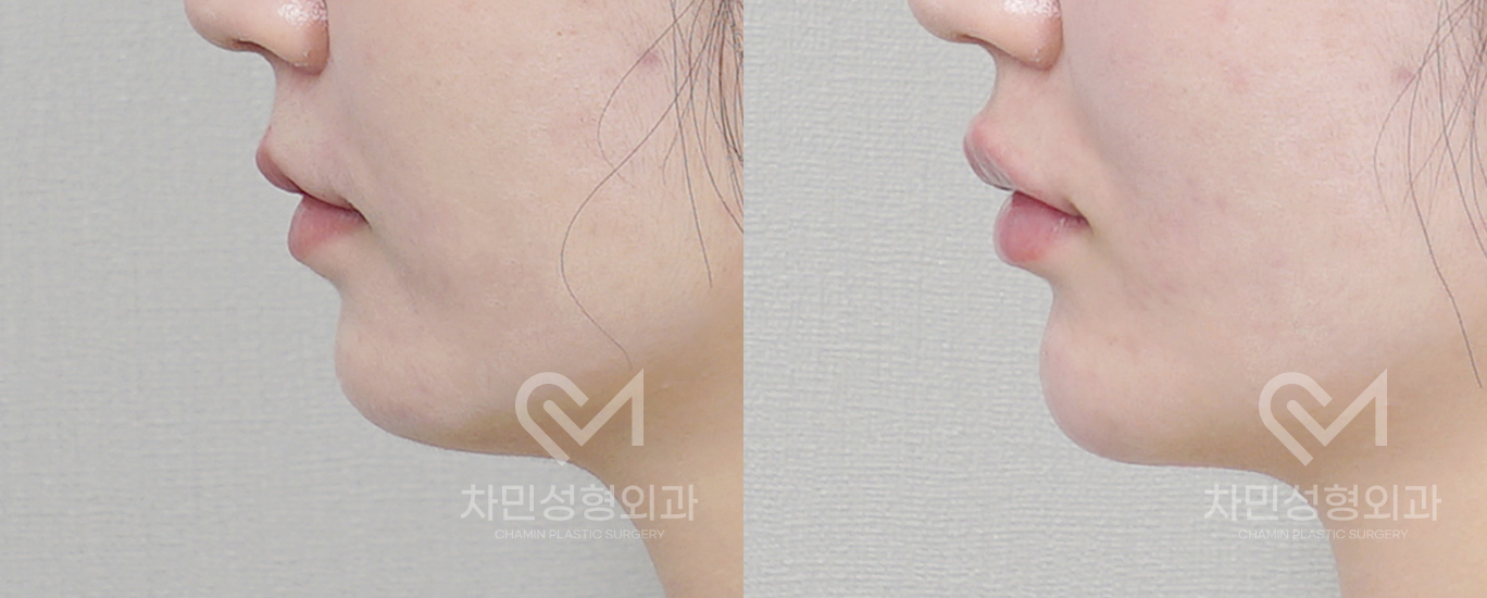 3번째 첨부파일