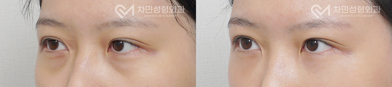 2번째 첨부파일
