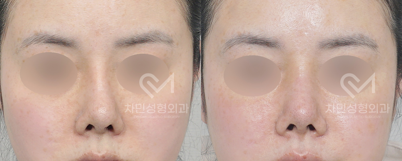 3번째 첨부파일