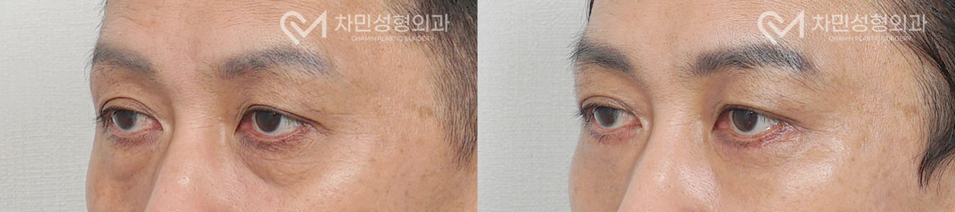 2번째 첨부파일