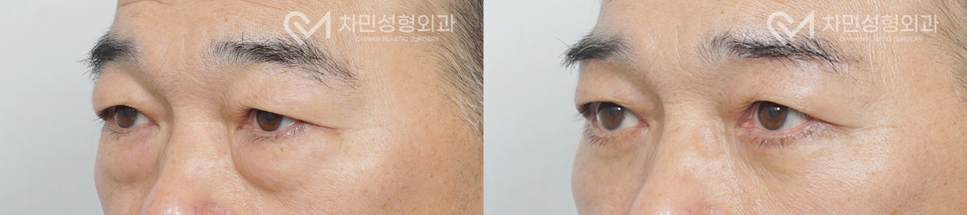 2번째 첨부파일