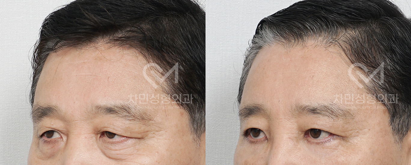 2번째 첨부파일