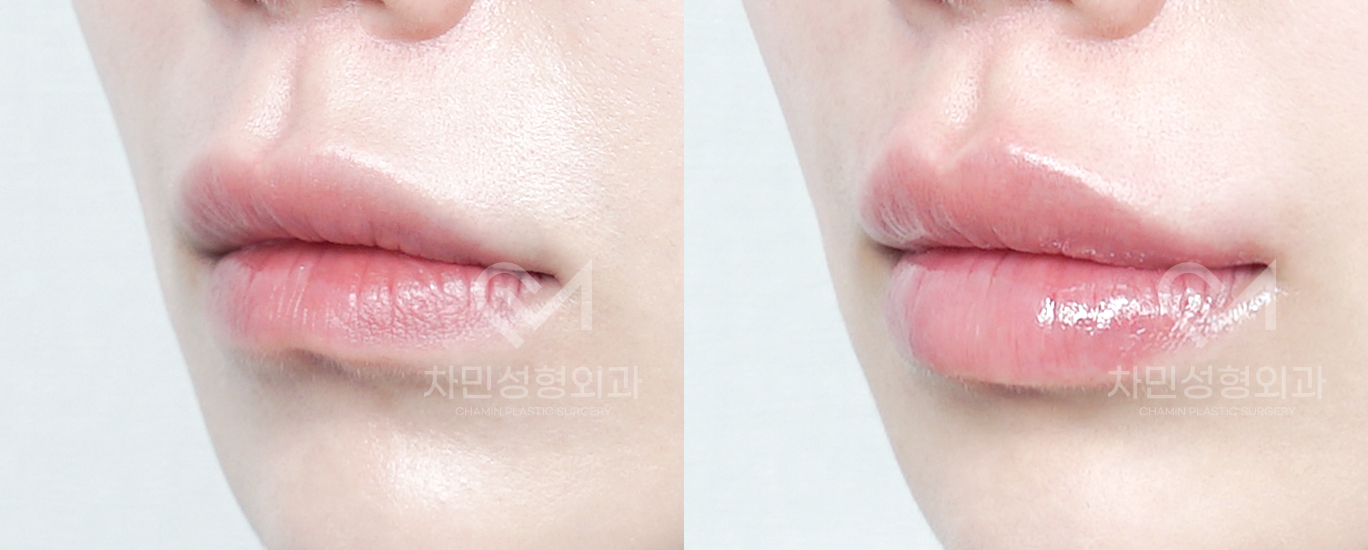 2번째 첨부파일