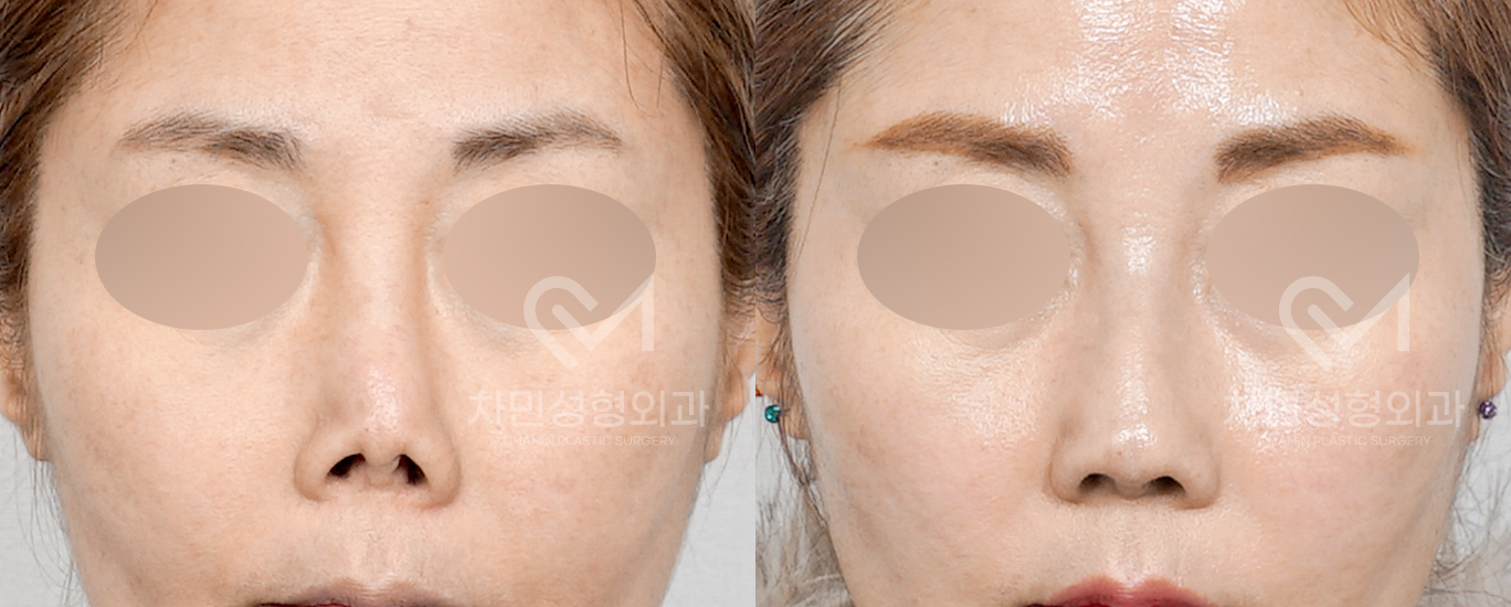 3번째 첨부파일