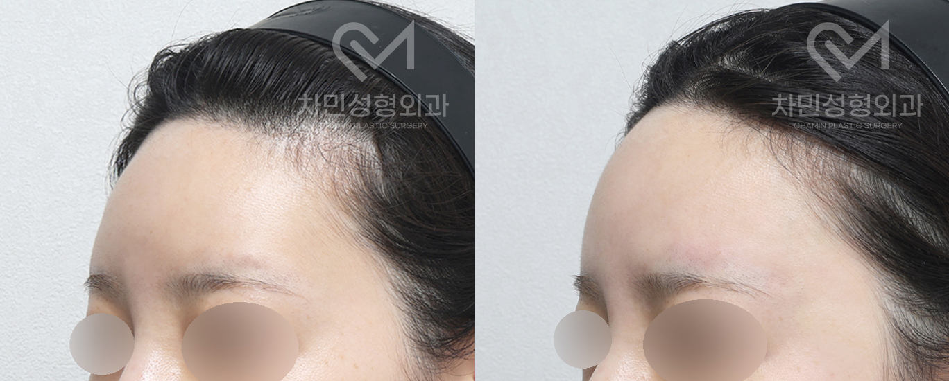 2번째 첨부파일