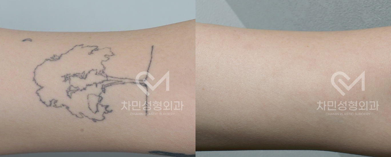 1번째 첨부파일