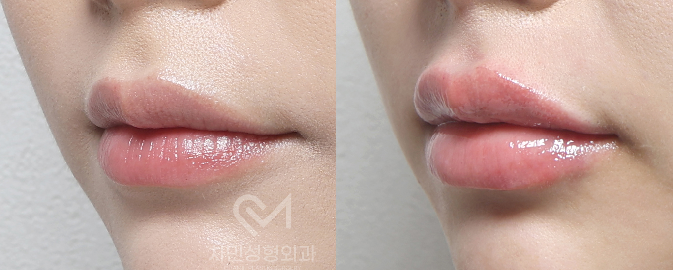 2번째 첨부파일