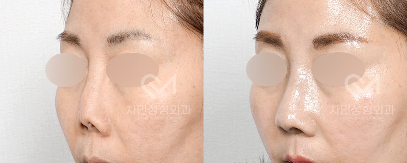 2번째 첨부파일