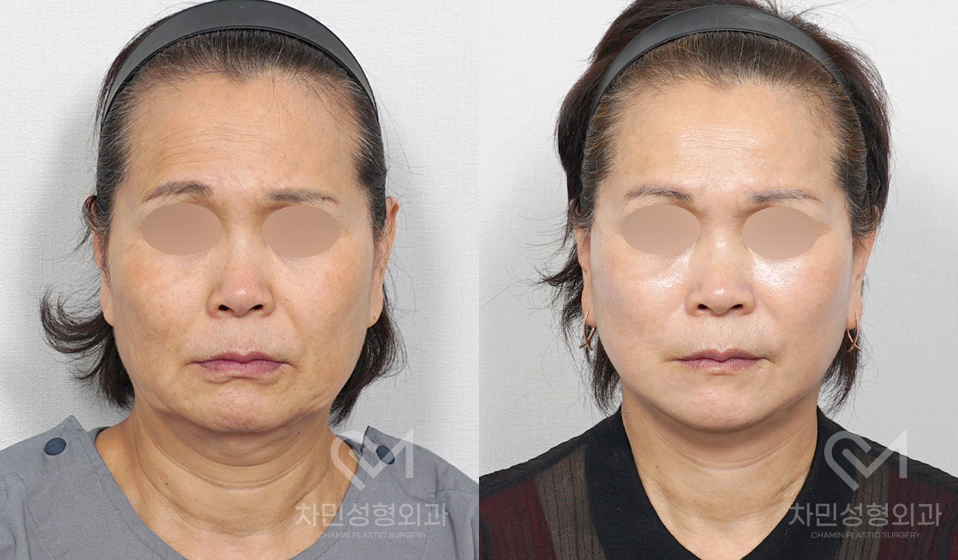 1번째 첨부파일