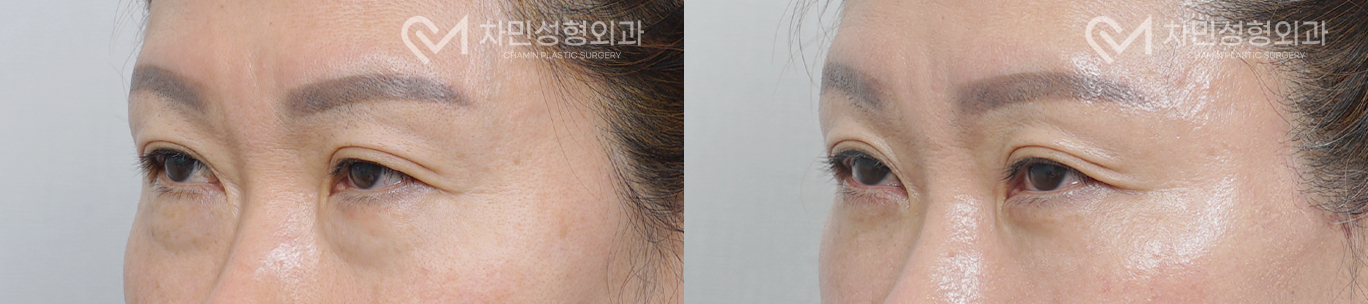 2번째 첨부파일