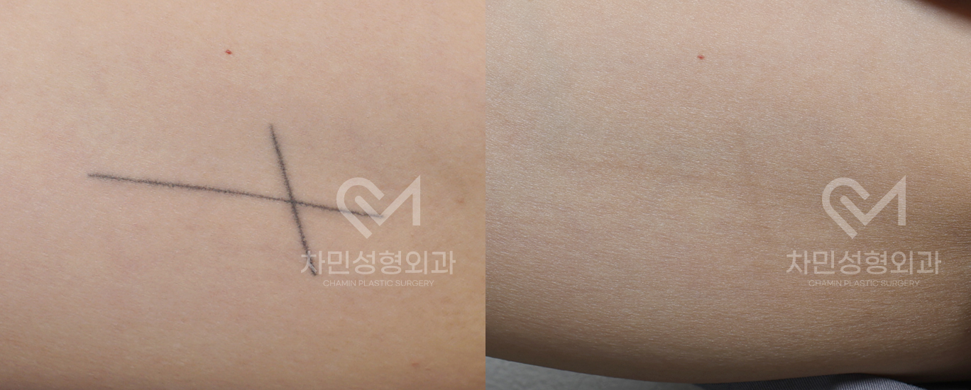 1번째 첨부파일