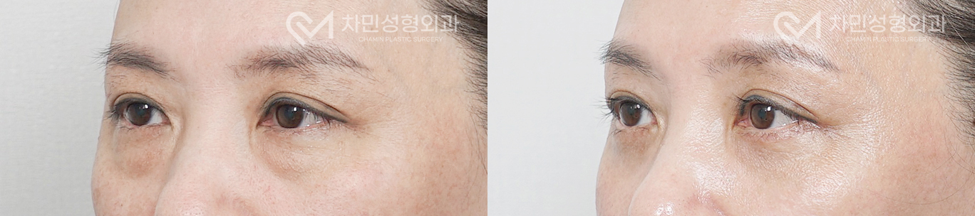 2번째 첨부파일