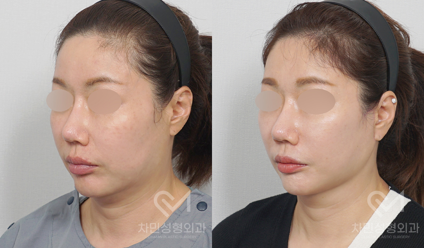 2번째 첨부파일