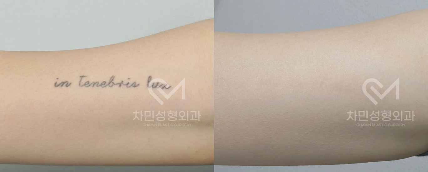 1번째 첨부파일
