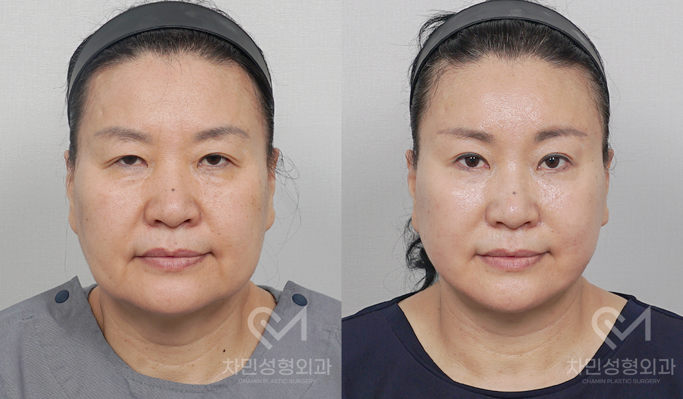 1번째 첨부파일