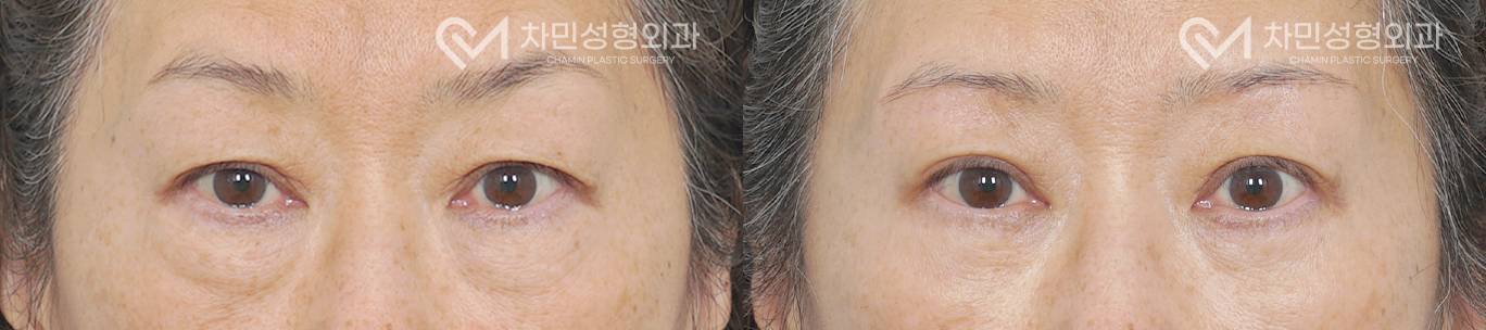 1번째 첨부파일