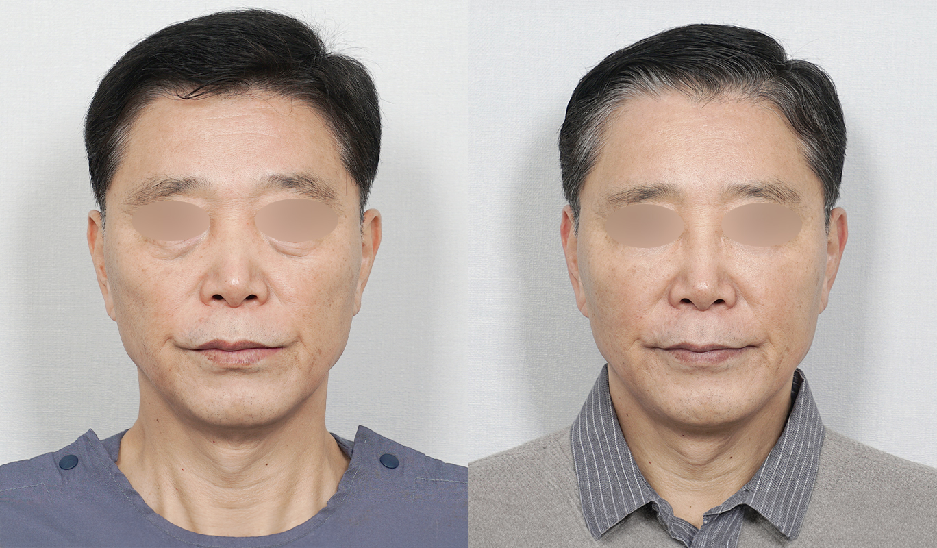 1번째 첨부파일