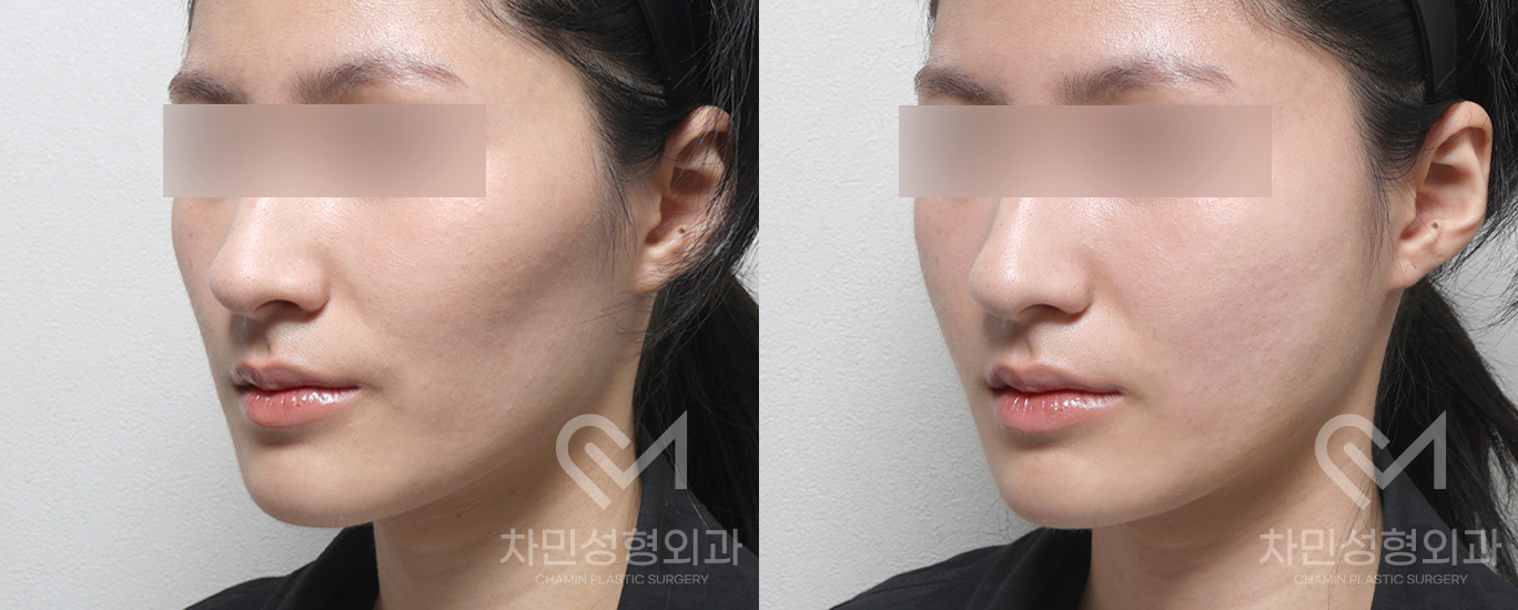 2번째 첨부파일