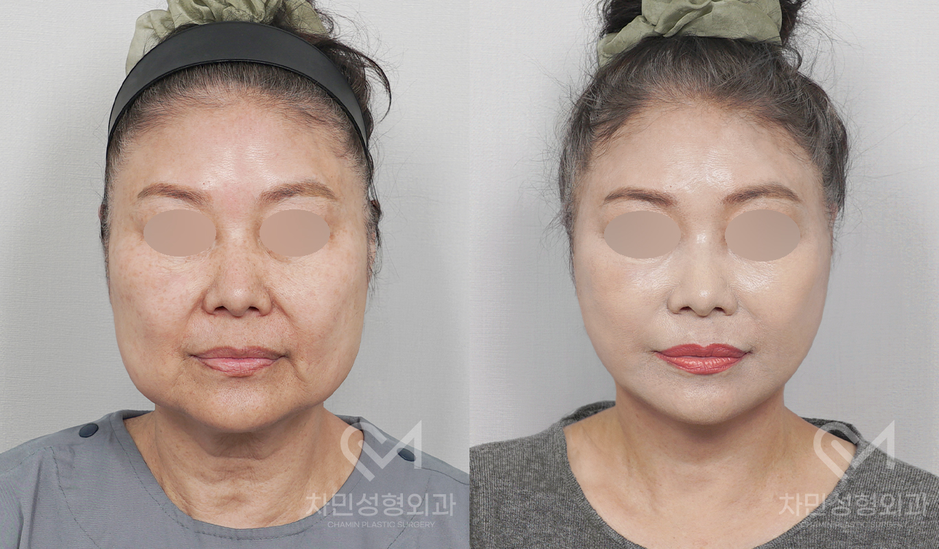 1번째 첨부파일