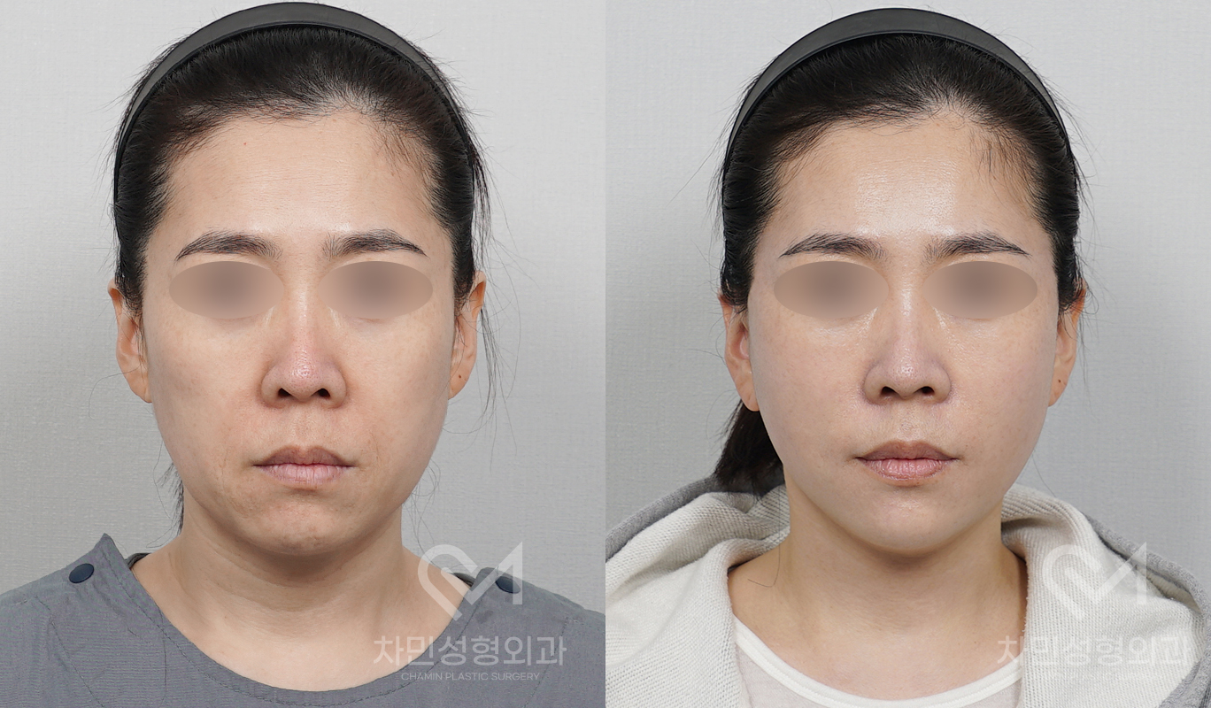 1번째 첨부파일