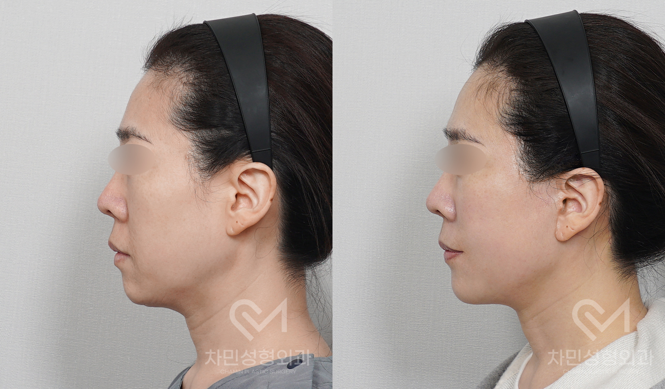 3번째 첨부파일