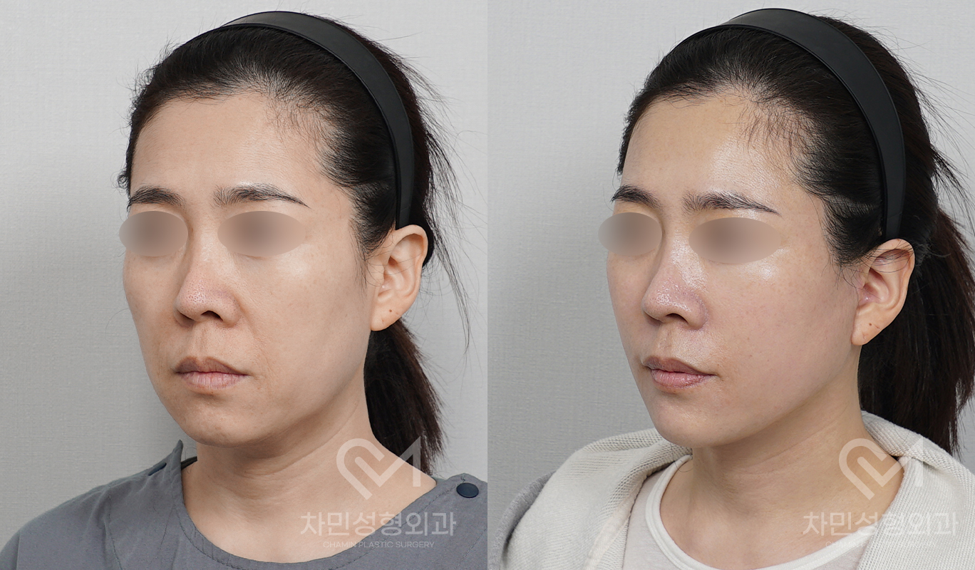 2번째 첨부파일