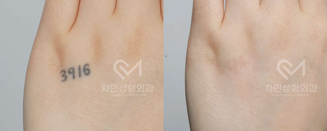 1번째 첨부파일