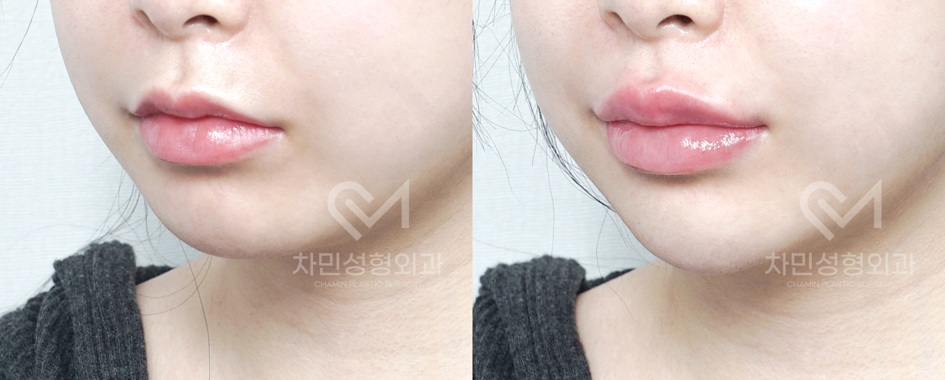 2번째 첨부파일