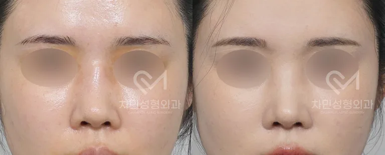 정면