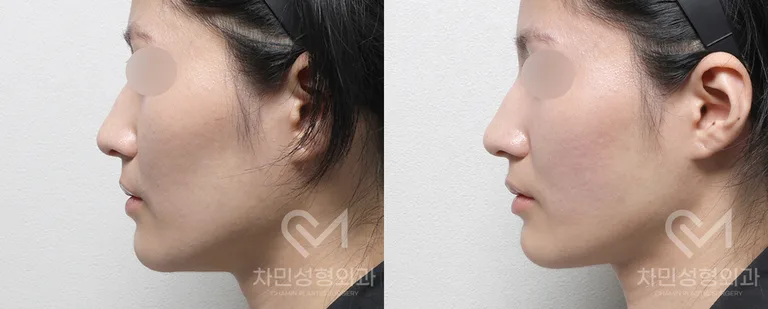 정면