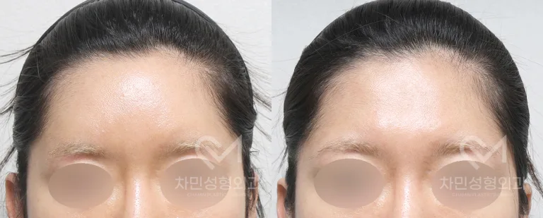 정면