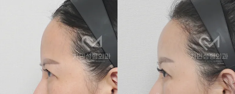 정면