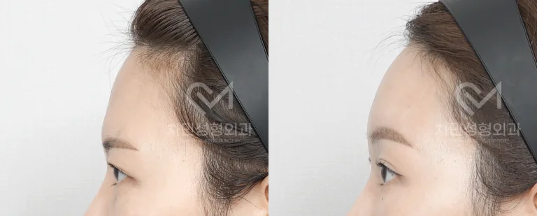 정면