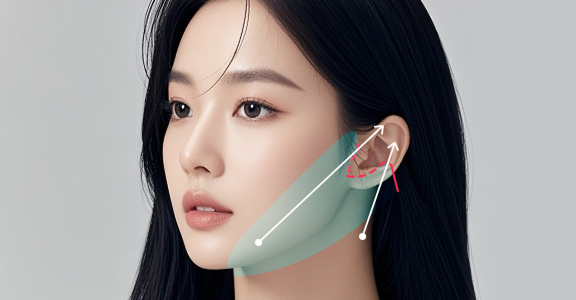 하안면부 리프팅