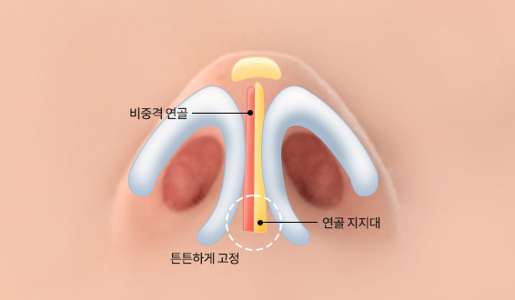 기능적 원인